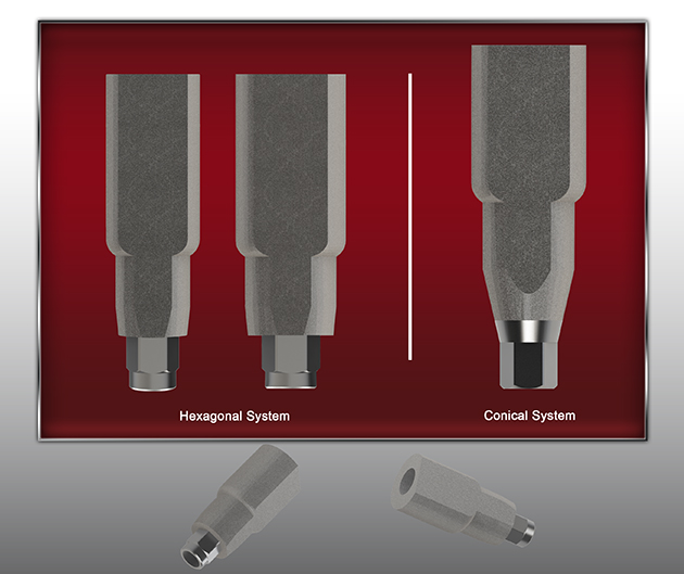 Drive dental implants - Body Scan